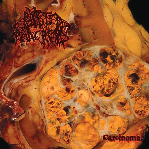 Carcinoma - Limited Edition Vinyl LP