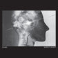 Direct Inject - Vinyl LP