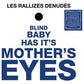 Blind Baby Has Its Mother's Eyes - Vinyl LP